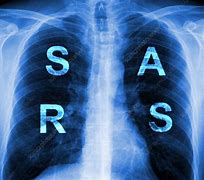 Image result for Severe Acute Respiratory Syndrome