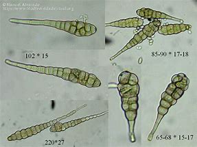 Image result for Alternaria Solani