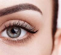 Image result for EyeLashes Infection