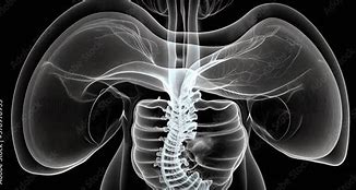 Image result for Stomach in X-ray