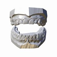 Image result for 3D Teeth Scanner