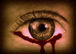 Image result for Bloody Eye