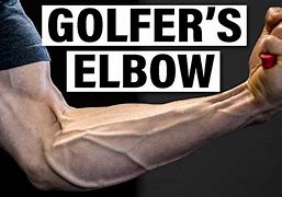 Image result for Rehab Golfers Elbow