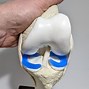 Image result for Knee Model Labeled