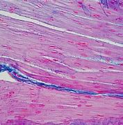 Image result for Micro Tears in Muscle Fiber Under Microscopes