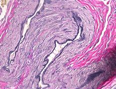 Image result for Uteres Histology