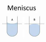 Image result for Artificial Meniscus