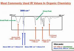 Image result for Ir Angiogram