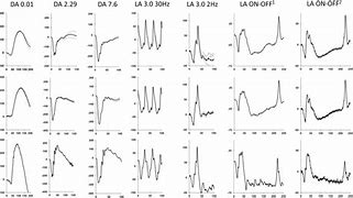 Image result for Normal Erg Eye