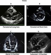 Image result for Rvit Echo View