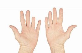 Image result for Ring Finger Injury