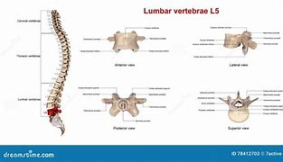 Image result for L5 Lumbar Vertebrae