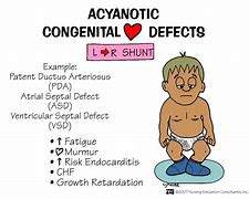 Image result for Cyanotic Heart Defect