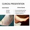 Image result for Charcot Bone Disease