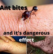 Image result for red ants bites