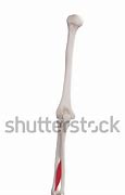 Image result for Extensor Pollicis Long Sensor Pinch