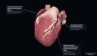 Image result for Atrioventricular Nodal Artery