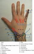 Image result for Dorsal Aspect Hand