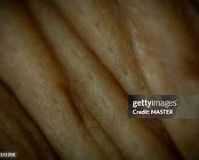 Image result for Macro Skin Pores