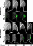 Image result for DDR and Bone Metastasis