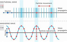 Image result for Transverse Spine