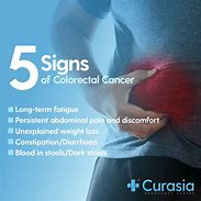 Image result for Pics of Colon Cancer