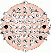 Image result for tDCS Placement Map