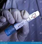 Image result for HIV-positive Pictures