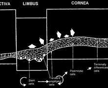 Image result for Limbus Cornea