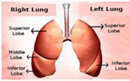 Image result for Multiple Lung Nodules