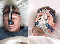 Image result for Osa Sleep Apnea