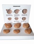 Image result for Prostate Disease