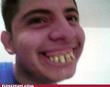 Image result for Brown Teeth Laugh