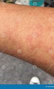 Image result for Skin Is Dust