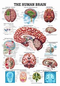 Image result for Brain Rot Prom Poster