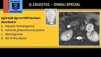 Image result for Light Bulb Sign Pheochromocytoma