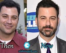 Image result for Jimmy Kimmel Before and After