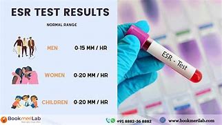 Image result for ESR Blood Test Icon