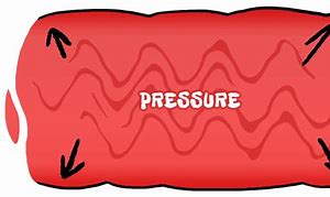 Image result for High Blood Pressure Animation