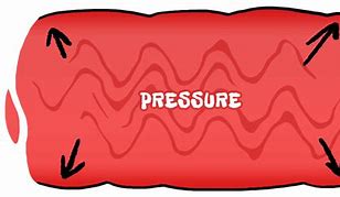 Image result for Blood Pressure Animation