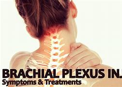 Image result for Brachial Plexus Injury