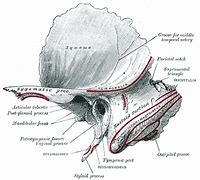 Image result for Middle Temporal Artery