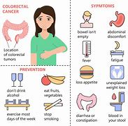 Image result for Colon Cancer Symptoms in Men Signs