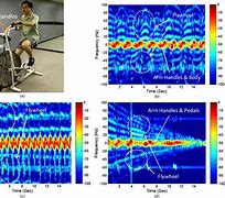 Image result for Pedal Pulse Doppler