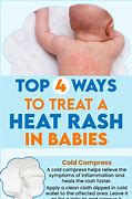 Image result for Soap for Heat Rash