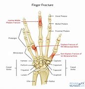 Image result for 3rd Digit Finger