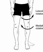 Image result for Lateral Knee Pain with Internal Rotation