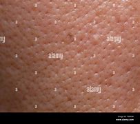 Image result for Macro Skin Pores