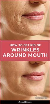 Image result for How to Remove Wrinkles around Mouth