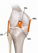 Image result for ACL MCL Meniscus